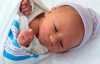 Лечение гидроцефалии у новорожденных